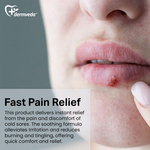 Cold sore treatment for fever blisters relief and fast healing.
