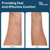 Side-by-side comparison of irritated skin with red bumps and smooth, healed skin after using Dermveda Ultra Bite Itch Relief
