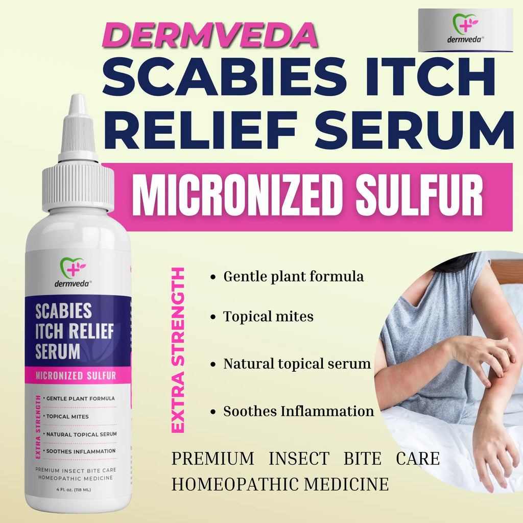 Dermveda Scabies Itch Relief for Humans - Sulfur-Based Itch Relief Cre