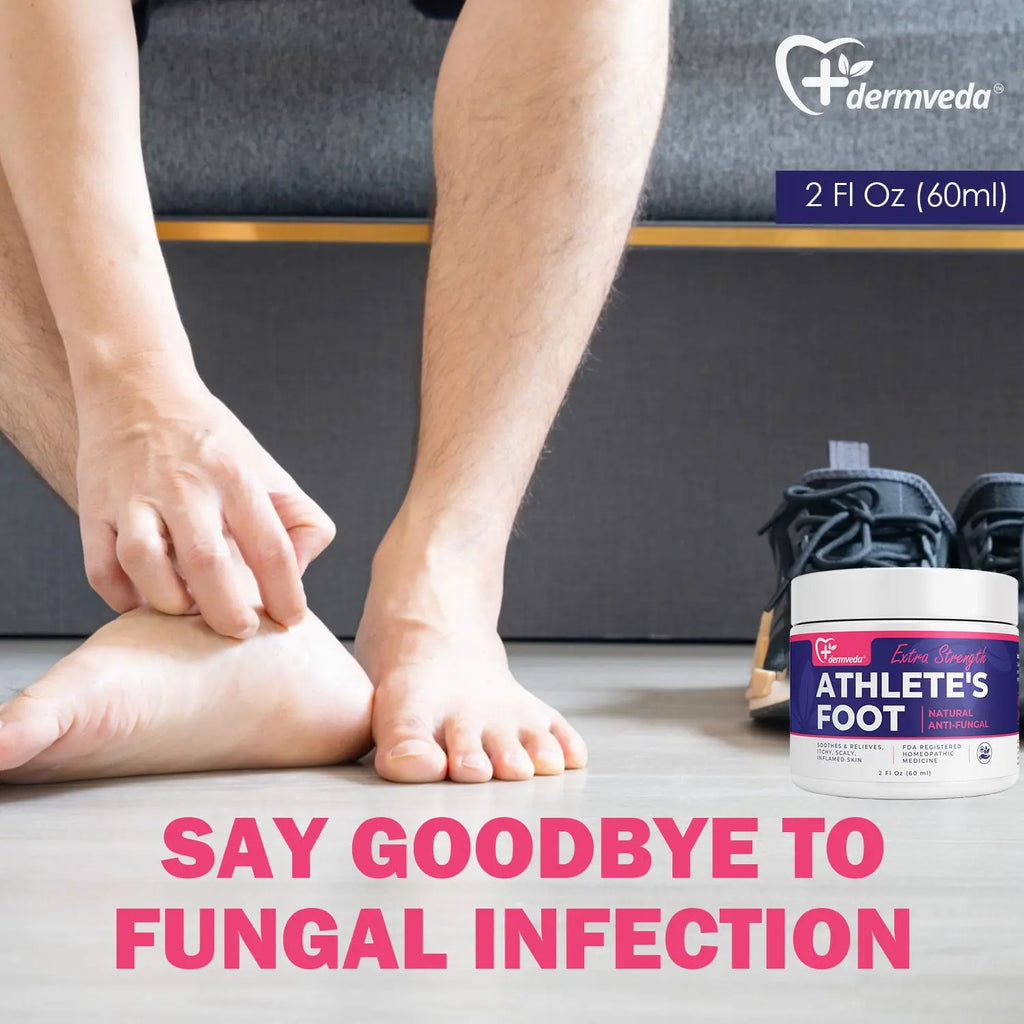 Athletes foot cream for natural anti-fungal treatment