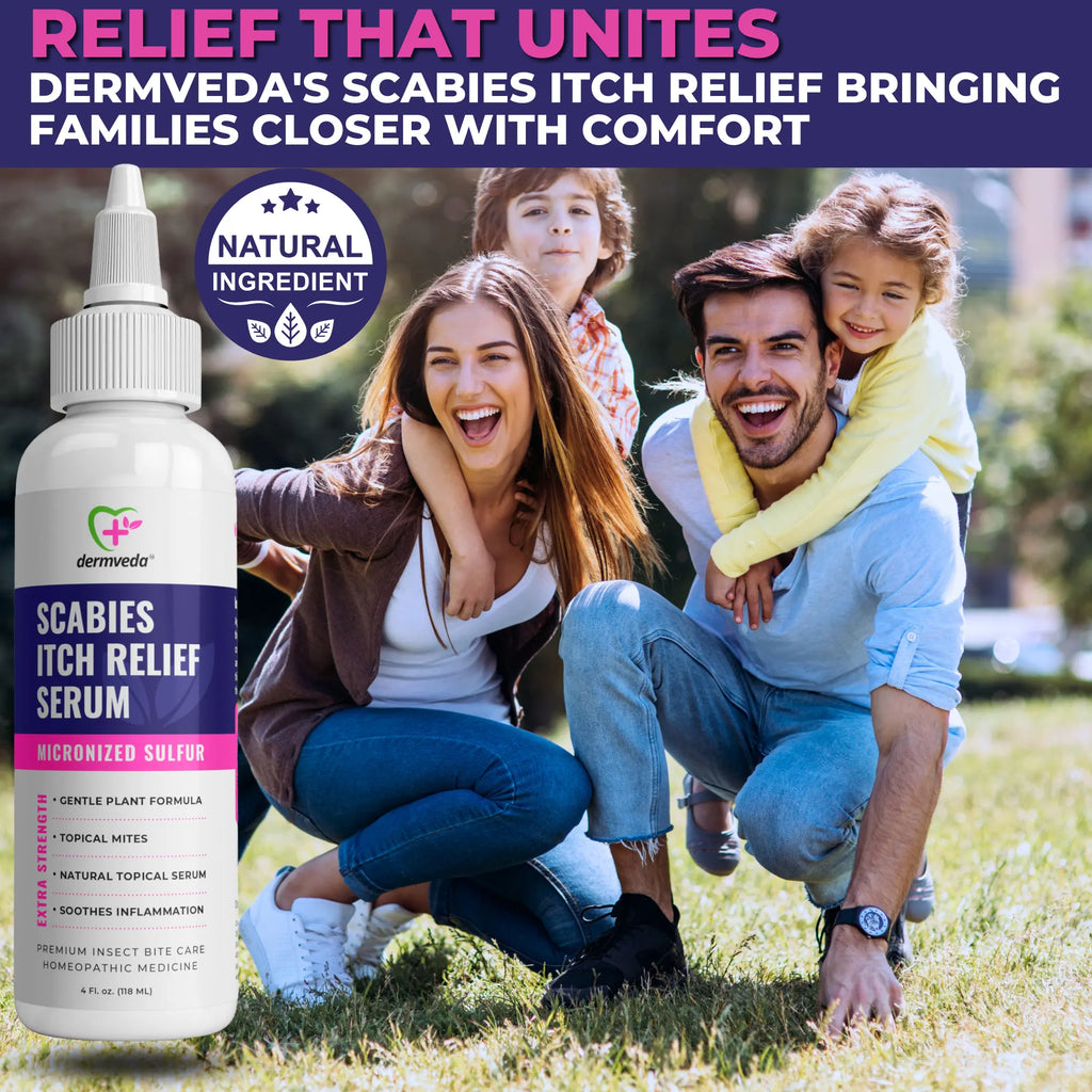 Dermveda Scabies Itch Relief for Humans - Sulfur-Based Itch Relief Cre