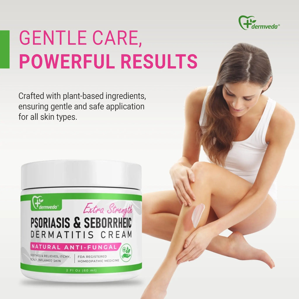 Woman applying soothing Seborrheic Dermatitis Cream for itchy skin relief