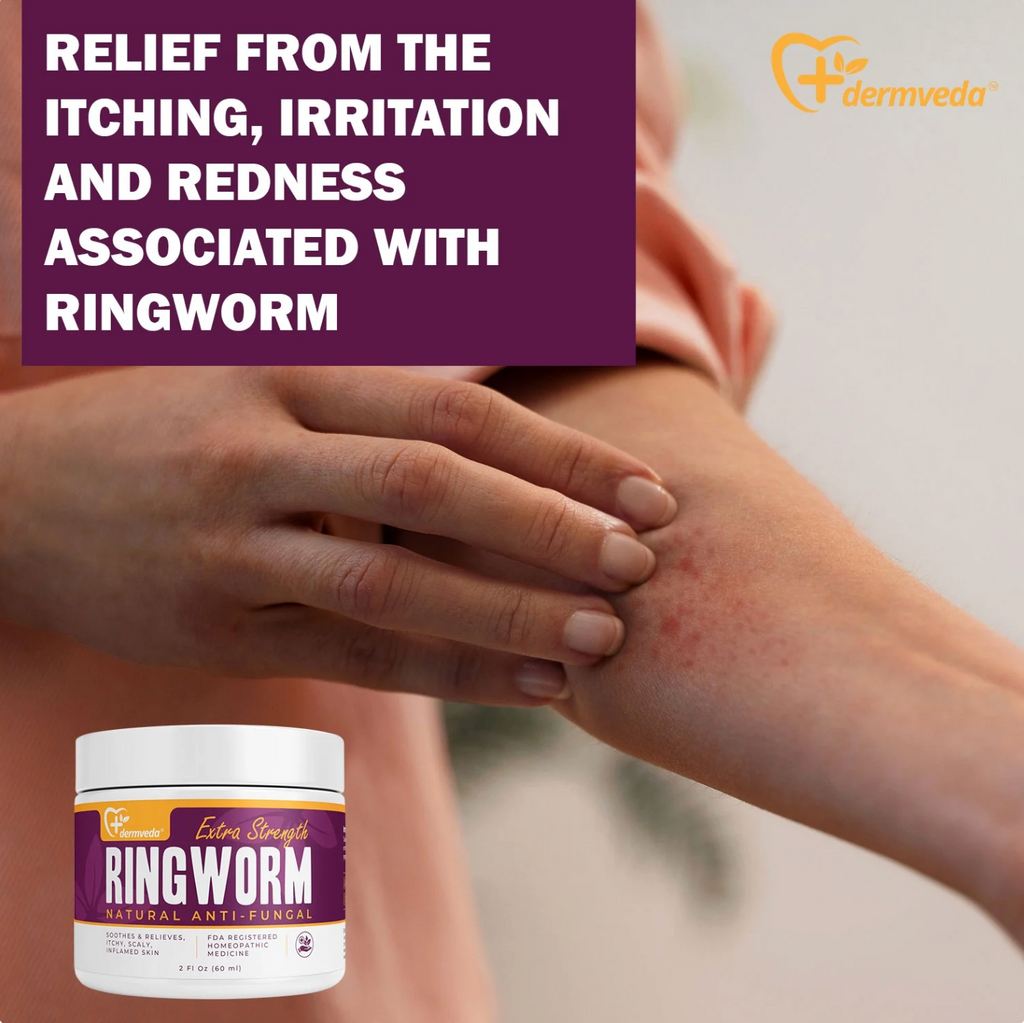 Dermveda ringworm cream for relief from itching and skin irritation