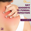 Effective ringworm treatment for humans, targeting fungal infection on skin.