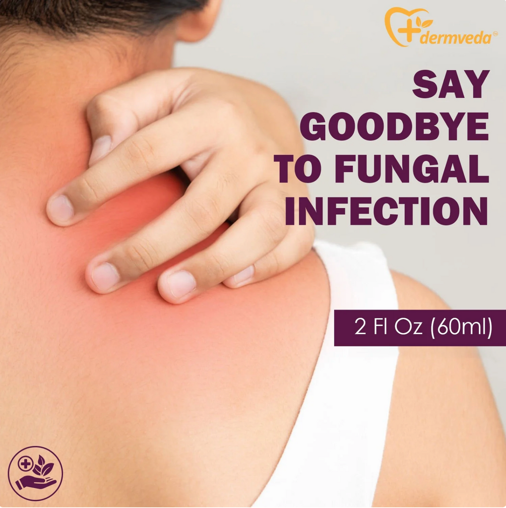 Effective ringworm treatment for humans, targeting fungal infection on skin.