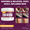Dermveda ringworm treatment showing before and after skin results