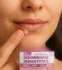 Dermveda Angular Cheilitis Cream – Natural Relief for Cracked Lips