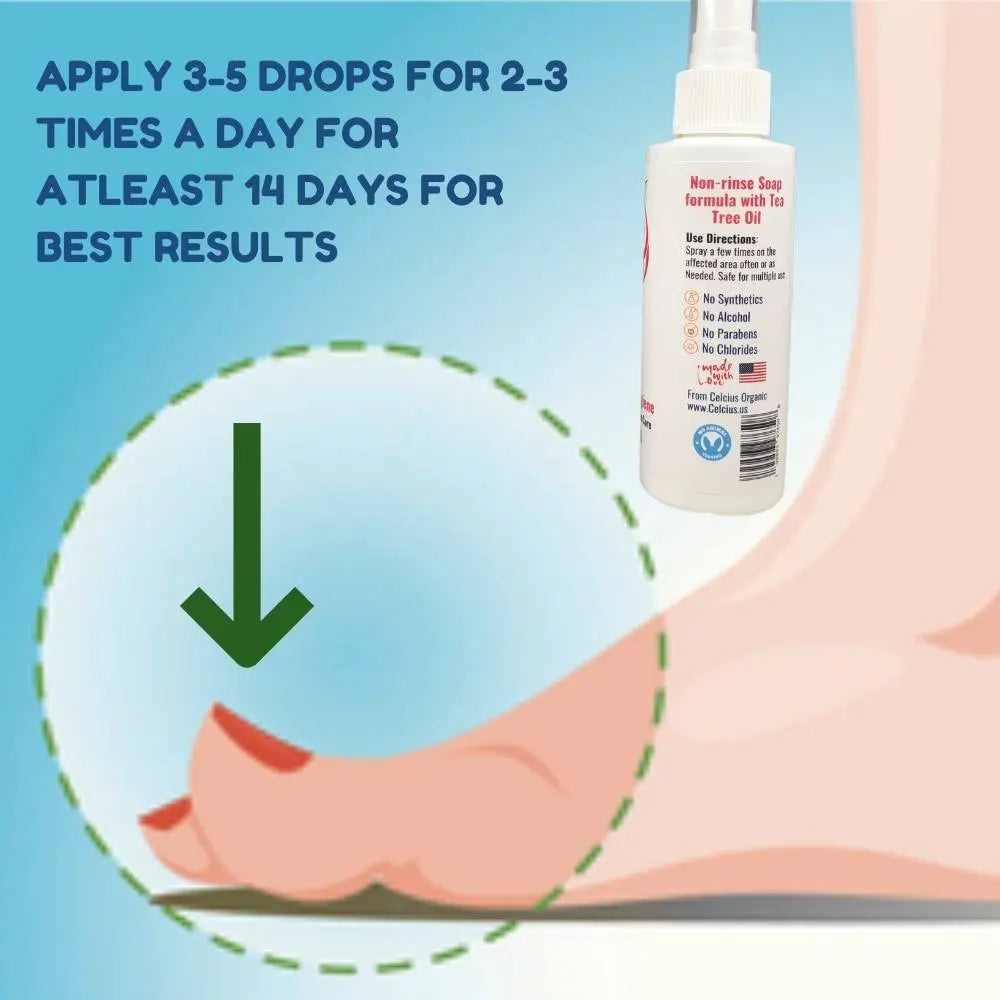 Toenail fungus solution with tea tree oil for damaged nail care.