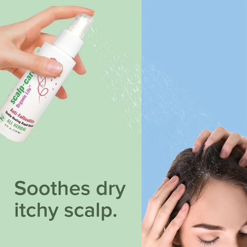 Herbal solution for Itchy Inflamed Scalp prone to Dandruff.